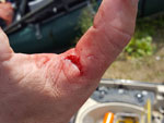 Matthew Randall's thumb after being attacked by a musky, before getting stitches..